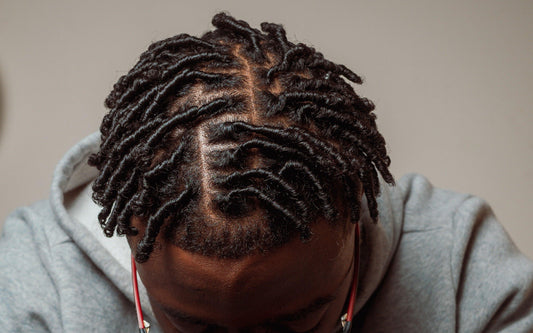 Why do Starter Locs itch?