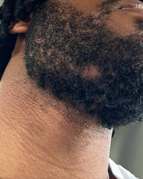 Close-up of a person's neck and shoulder with visible hair.