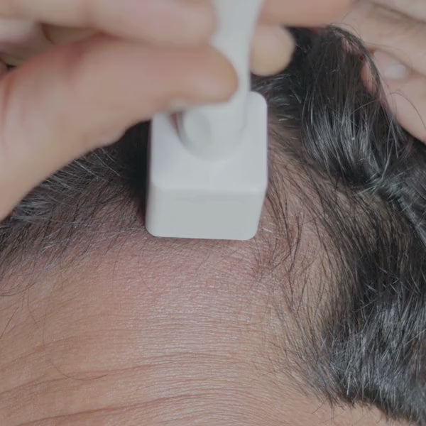 derma stamping for hair growth